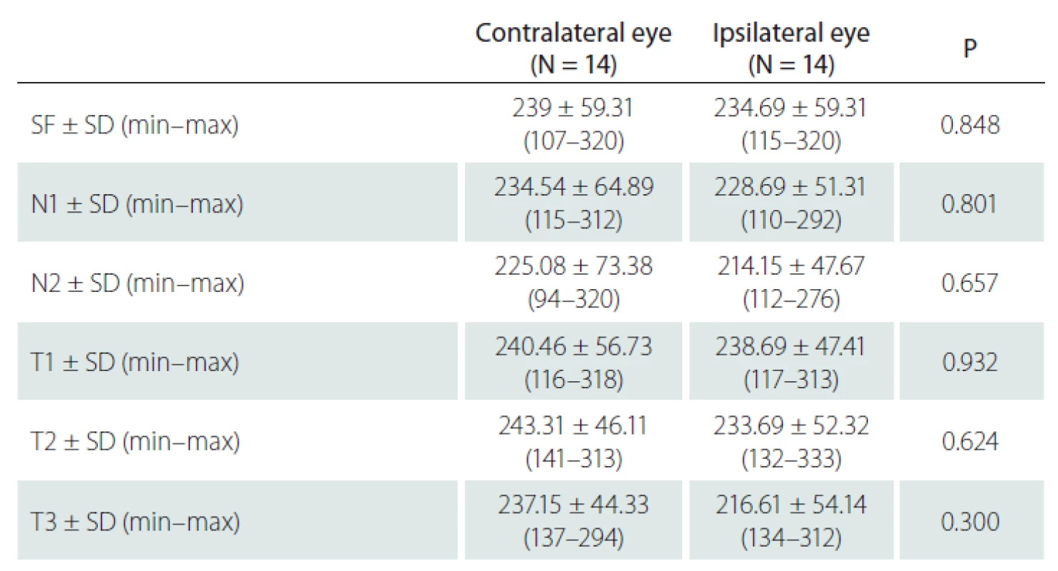 The comparison of choroidal thickness values of the eyes in subjects with
unilateral carotid artery disease.