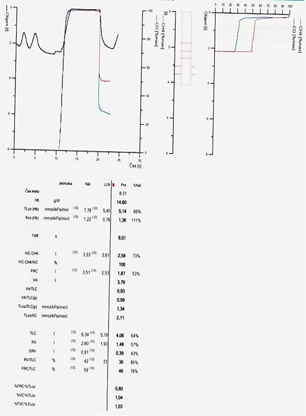 Fixní kombinace LABA/LAMA v léčbě chronické obstru... | proLékaře.cz