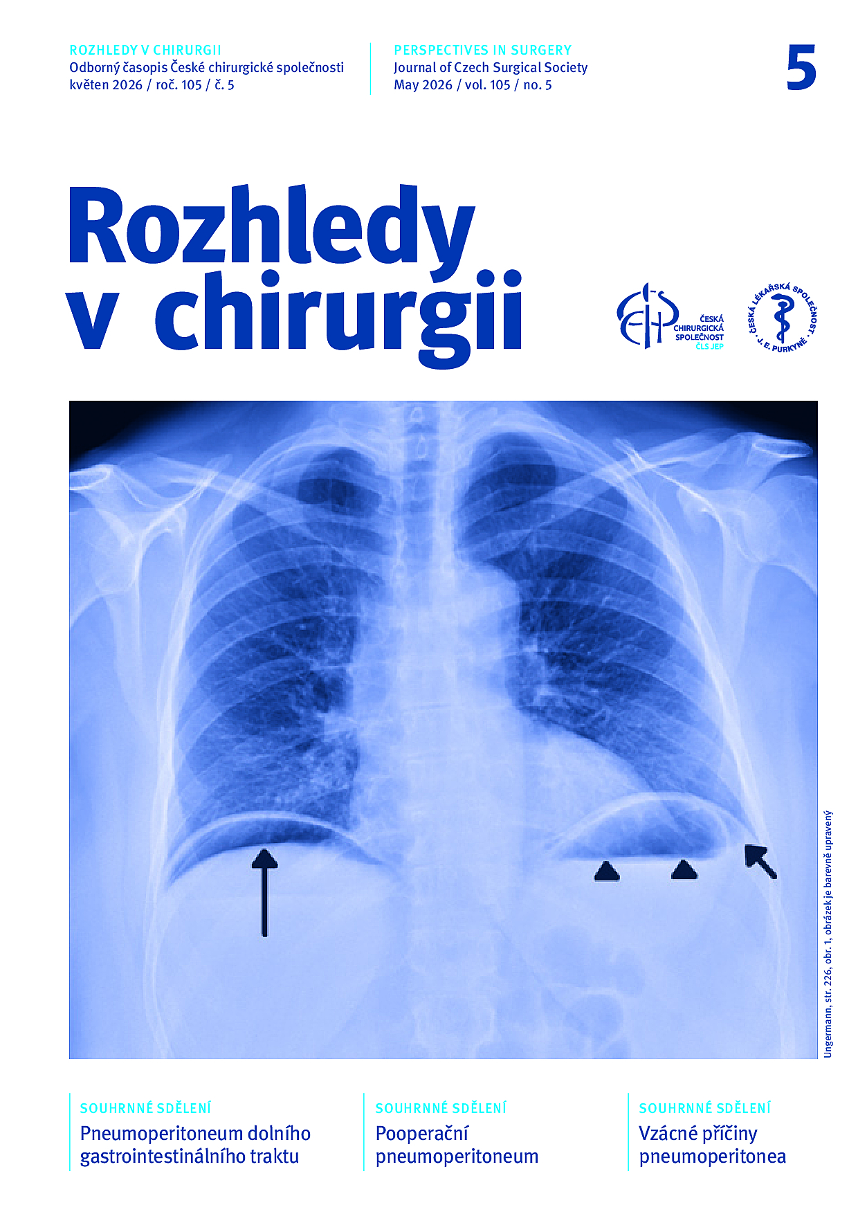 Rozhledy v chirurgii